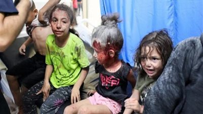 الجزائر: استقبال 400 طفل فلسطيني مصاب لتلقي العلاج