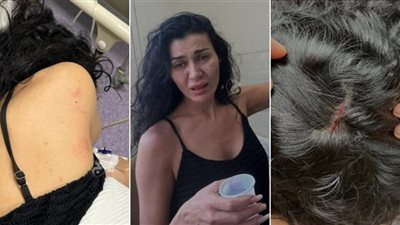 تفاصيل تعرض الفنانة اللبنانية نادين الراسي للضرب على يد شقيقها الأصغر 