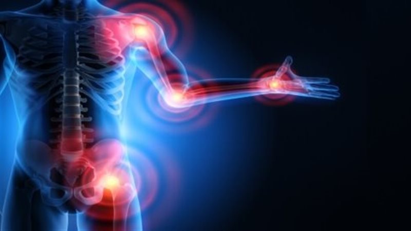 التهاب المفاصل