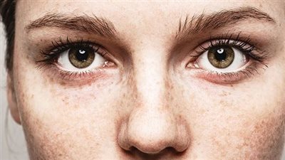 الصحة النفسية والأمراض الجلدية: كيف تؤثر مشاعرك على صحة جلدك؟