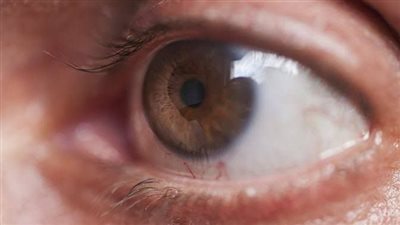 أسباب مرض الجلوكوما: كيف يحدث وطرق العلاج الفعّالة