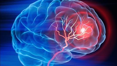 مخدر الشابو: السم القاتل الذي يدمر الدماغ ويسبب السكتات الدماغية والجلطات القلبية