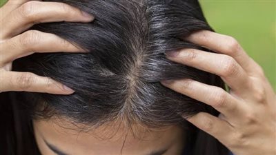 لماذا يظهر الشعر الأبيض؟ اكتشف الأسباب وكيفية التعامل معها