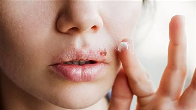 فيروس مرتبط بالتهابات الأمعاء قد يساهم في تطور ألزهايمر والهربس