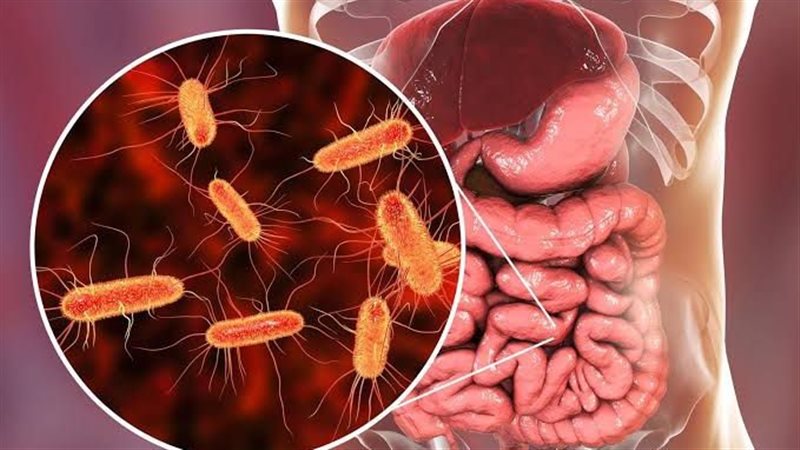 جرثومة المعدة