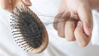 هل تعاني من تساقط الشعر؟ قد يكون السبب نقص هذا المعدن بجسمك