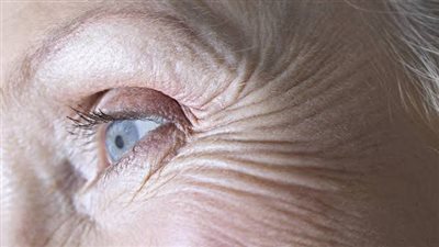 عادات يومية تسرّع ظهور التجاعيد.. أبرزها إهمال التغذية السليمة