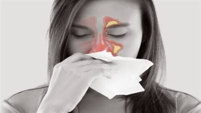 علاج الجيوب الأنفية بطريقة صحيحة.. تعرف على الأنواع المختلفة لها