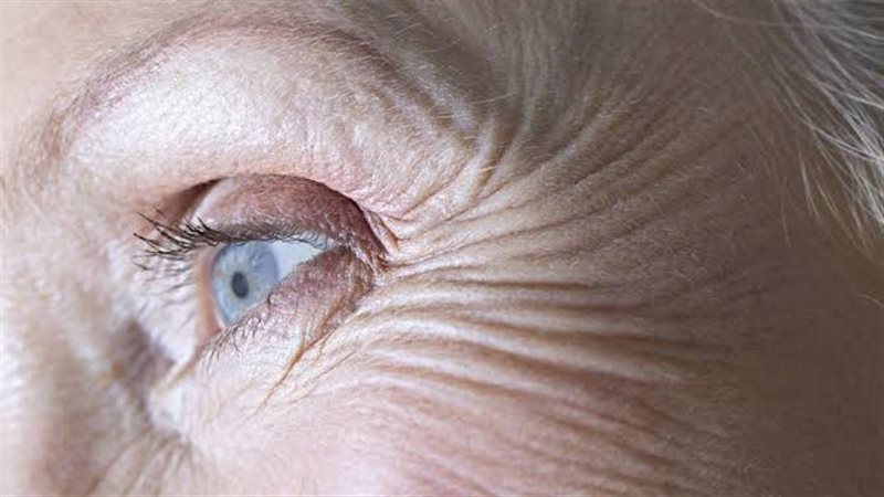 تجاعيد العين