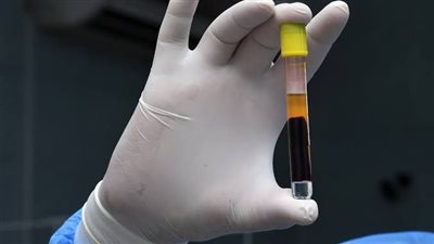 مرض الثلاسيميا في مسلسل بالدم.. أسبابه وأعراضه وطرق علاجه