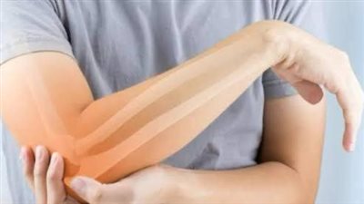 لمرضى التهاب المفاصل.. تجنبوا هذه الأطعمة خلال الصيام