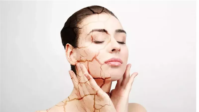 البشرة الحساسة 