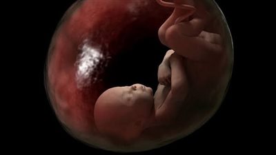 هل يجوز الإجهاض بعد نفخ الروح لحماية حياة الأم؟..  الإفتاء توضح 