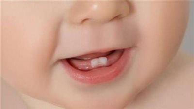 «أبرز 3 إشارات» تدل على بدء مرحلة «تسنين الأطفال» وكيفية التعامل معها