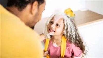 في اليوم العالمي ل «البهاق».. خطوات لتعزيز ثقة الأطفال المصابين بأنفسهم بفعالية