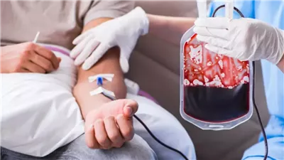 مفاجأة طبية.. هل يساعد التبرع بالدم فعلًا في تحفيز نمو الشعر؟ 