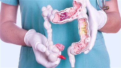 علامات غير متوقعة لسرطان القولون.. إليك طرق الوقاية والكشف المبكر