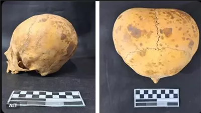 جمجمة «مفلطحة» لطفل تثير دهشة العلماء بالأرجنتين.. اكتشاف يعود لـ 700 عام