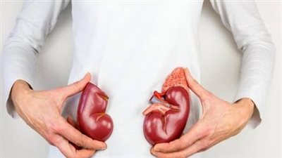 حصوات الكلى تبدأ من هنا.. 3 عادات يجب التخلص منها فورًا