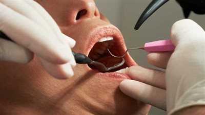 هل يؤثر «فينير الأسنان» على صحة الوضوء والغُسل؟..  الإفتاء توضح الحكم