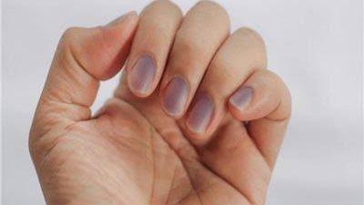 احذر .. لون أظافرك قد يكشف «مشكلة قلبية خطيرة» لا تظهر بوضوح