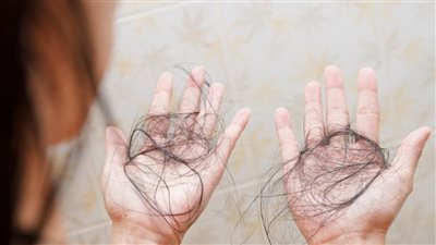 تساقط الشعر يزداد صيفا؟ تعرف على الأسباب وطرق الوقاية