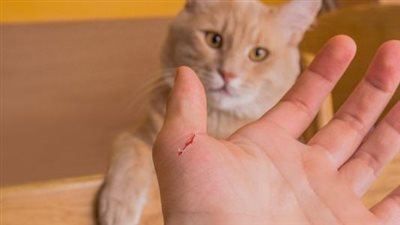 خطر صامت.. «خدشة القطة» قد تصيبك بعدوى خطيرة