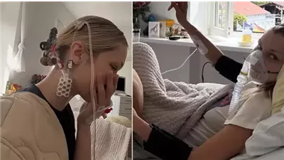 مرض بيلا حديد يكشف خفايا «داء لايم» وأعراضه