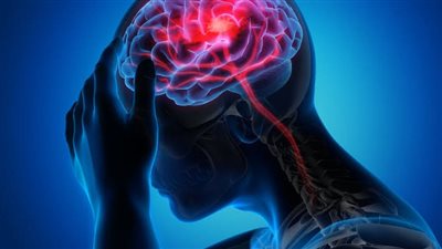 كيف تتصرف لإنقاذ مصاب بـ«سكتة دماغية» بسرعة 