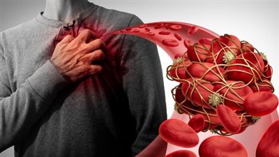 «تعفن الدم».. أسبابه وأعراضه ومتى يصبح خطرا قاتلا