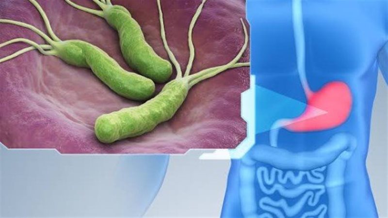 جرثومة المعدة