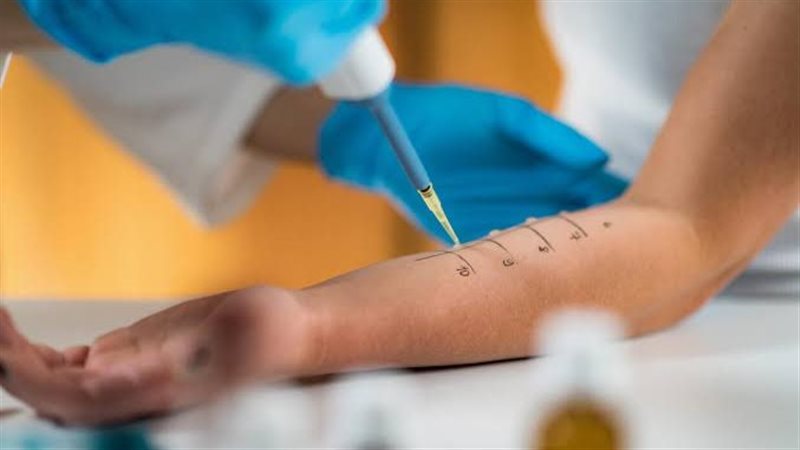 لقاح الحساسية 