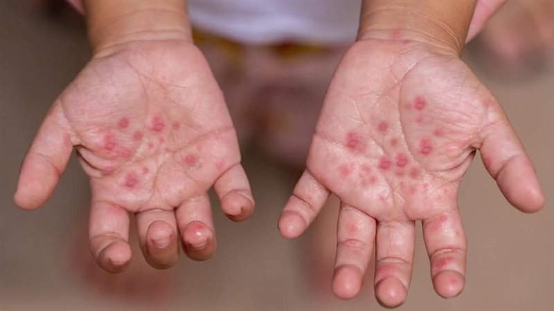 فيروس المدارس 