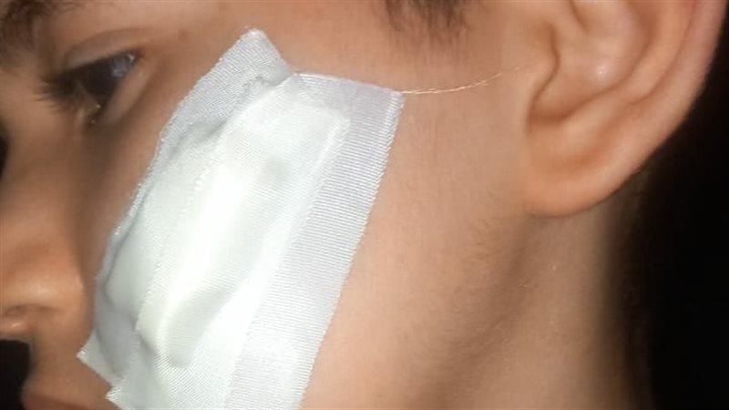 الطفل المصاب