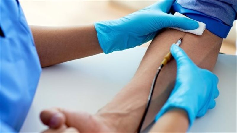 داء ترسب الأصبغة