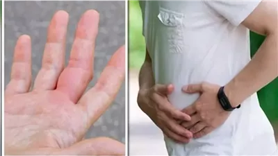 علامات خطيرة تكشف تلف الكبد مبكرا في اليدين والقدمين