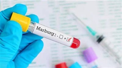 تحذيرات جديدة من انتشار ماربورج وطرق انتقال الفيروس
