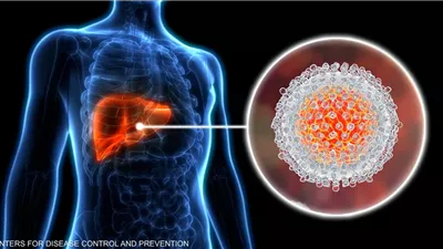 ٤ مؤشرات تحذيرية خطيرة تكشف وجود خلل بالكبد