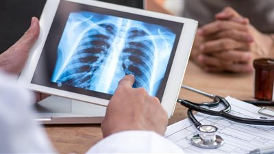 تبدأ بنزلة برد بسيطة.. احذر الالتهاب الرئوي الفيروسي