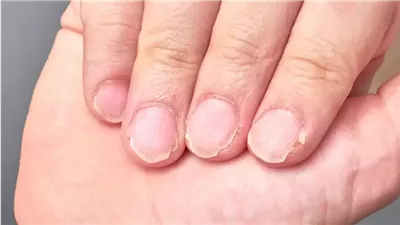 دليلك الشامل لترميم وتقوية الأظافر التالفة والضعيفة
