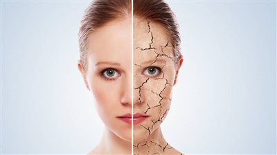 علامات خطيرة.. دليلك الشامل لترميم حاجز البشرة المتضرر