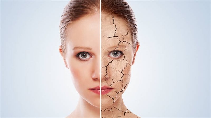 ترميم حاجز البشرة المتضرر